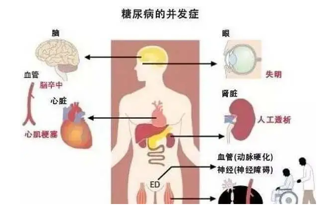 不负盛名不负期待| 青滨附院内分泌代谢科成功治愈两名疑难糖尿病并发症患者